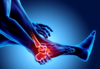 Diabetes Can Increase the Risk of Foot Joint Problems